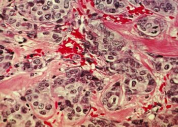 ابتكار مجهر لرؤية خلايا سرطانية بحجم جزء من100من المليمتر بقلم أسامةخليل