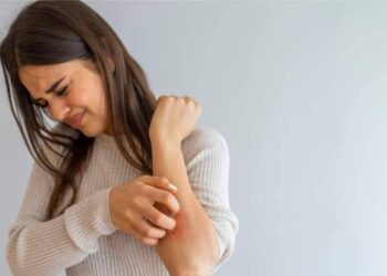 اعرف الصح تعرف على أسباب ظهور البقع الحمراء على الجسم بقلم أسامة خليل