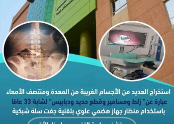 استخراج زلط وحديد ومسامير من معدة فتاة بمستشفى طيبة التخصصى بالأقصر
