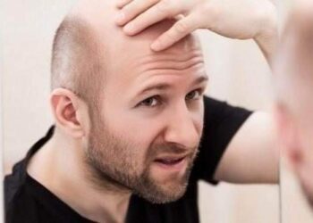 حتى لا يضيع عمرك هباءً ” .. مشروبات شائعة تؤدي إلى الصلع أحذر من تناولها !!