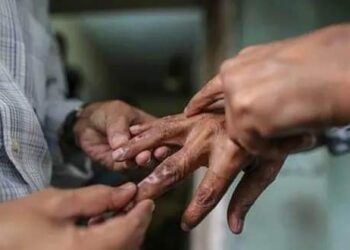 في يومه العالمي.. الجذام يسبب معاناة نفسية للمصابين به