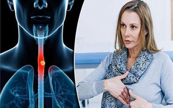 أعراض عند تناول الطعام قد تنذر بالإصابة بسرطان المريء ..