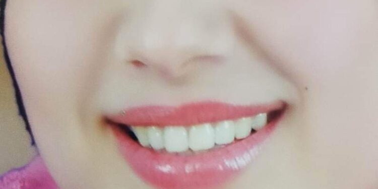 أنــا وإنـت …