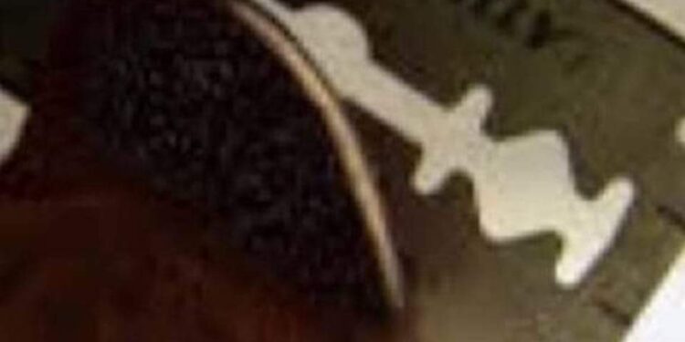 الــعــاق …