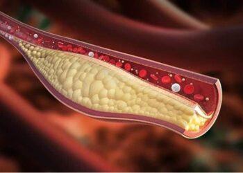 الألم الشديد” قد يكون علامة تحذيرية لارتفاع مستويات الكوليسترول في الدم