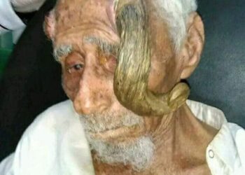 بعد بتر قرنيه.. وفاة المعمر اليمني “ذي القرنين” عن 140 عاماً