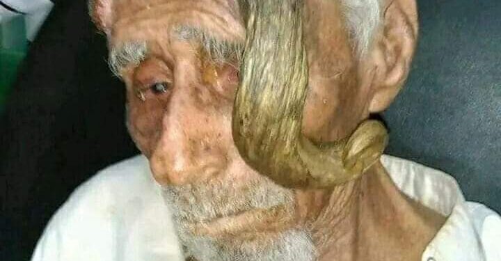 بعد بتر قرنيه.. وفاة المعمر اليمني “ذي القرنين” عن 140 عاماً