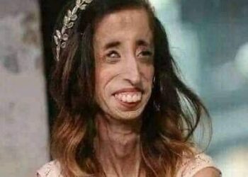 ليزا الجميلة..أكثر إمرأة قبحاً في العالم !!