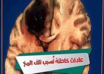 الأسباب الرئيسية المسببة لتلف العقل