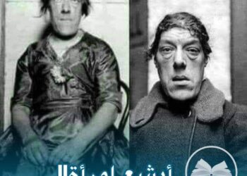 أبشع امرأة في العالم …