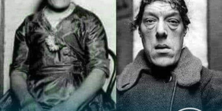 أبشع امرأة في العالم …