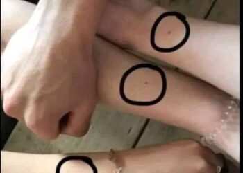 هل كل النساء لديهن نفس الشامة على معصم اليد ؟!