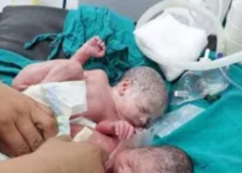 ولادة طبيعية لـ3 توائم بصحة جيدة في بالمنوفية