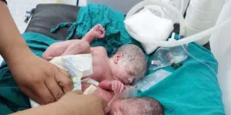 ولادة طبيعية لـ3 توائم بصحة جيدة في بالمنوفية