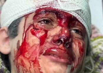 نداء أطفال الحجارة