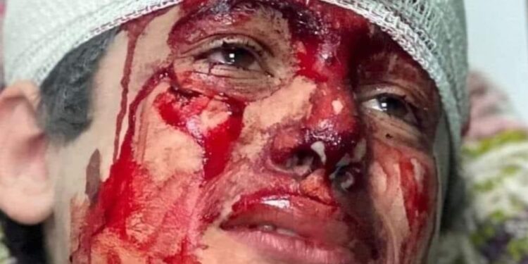 نداء أطفال الحجارة