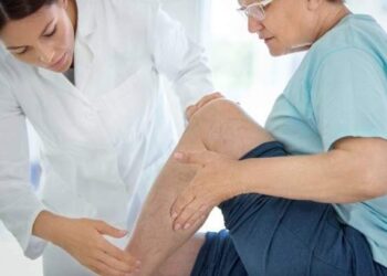 دوالي الساقين.. الأسباب وطرق الوقاية