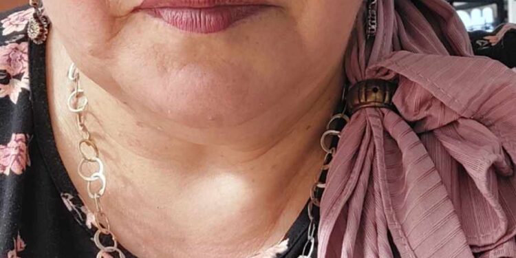 يحدث أن تنفطر كبد السّماء