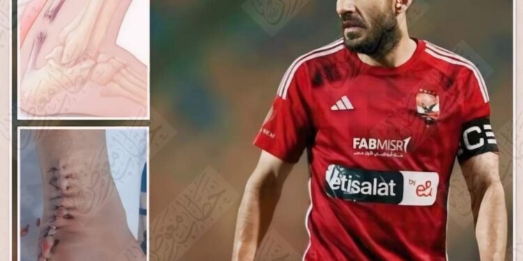 حكاية وتر أكيليس بين إصابة علي معلول وحرب طروادة …