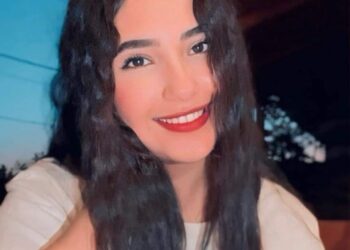 الشّفاه العجولة