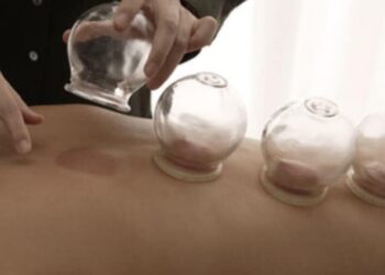 الحجامة ما لها وما عليها