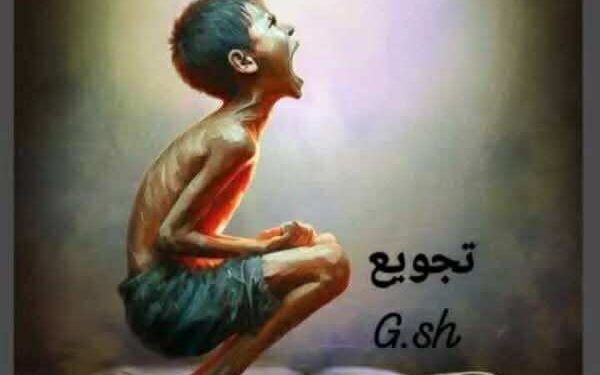 تجويع …