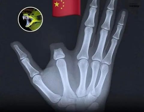 رجل يقطع إصبعه بيده بعد لدغة ثعبان أسطوري.. المفاجأة في المستشفى!